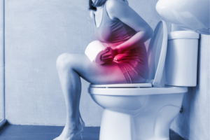 Diferencia entre estreñimiento y obstrucción intestinal